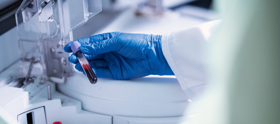 Técnico manuseia amostra de sangue em laboratório.